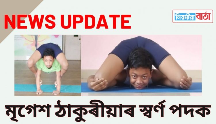 mrigesh